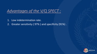 Advantages of the V/Q SPECT :
1. Low indetermination rate.
2. Greater sensitivity ( 97% ) and specificity (91%) .
 