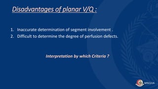 Disadvantages of planar V/Q :
1. Inaccurate determination of segment involvement .
2. Difficult to determine the degree of perfusion defects.
Interpretation by which Criteria ?
 