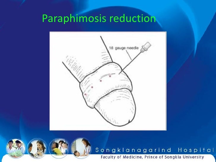 Emergency surgical procedures