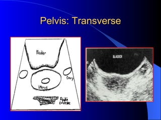 Pelvis: Transverse 