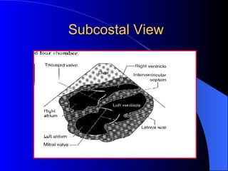 Subcostal View 