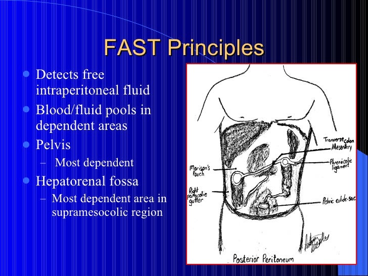 Emergency Ultrasound In Trauma