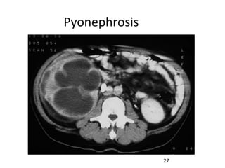 Emergency in Urology [Dr. Edmond Wong] | PPT