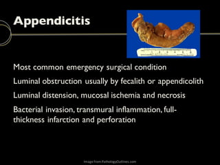 Emergency Ultrasound: Bowel | PDF