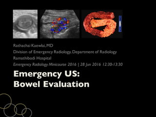 Emergency US:
Bowel Evaluation
Rathachai Kaewlai,MD
Division of Emergency Radiology, Department of Radiology
Ramathibodi Hospital
Emergency Radiology Minicourse 2016 | 28 Jun 2016 12:30-13:30
 