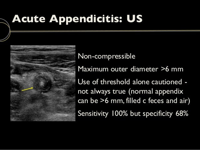 Emergency Ultrasound: Bowel