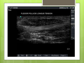 Conclusions
1. Imaging tool – Must have the knowledge to
understand how the image is formed
2. Dynamic technique
3. Acquis...