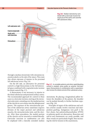 Emergency vascular surgery_a_practical_guide | PDF