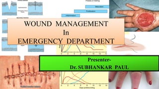 Presenter-
Dr. SUBHANKAR PAUL
WOUND MANAGEMENT
In
EMERGENCY DEPARTMENT
 