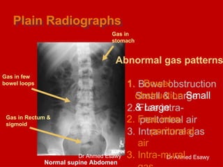 Comprehensive Guide to Chest and Abdominal X-Ray Interpretation in ...