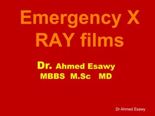 Dr Ahmed Esawy
Emergency X
RAY films
Dr. Ahmed Esawy
MBBS M.Sc MD
 