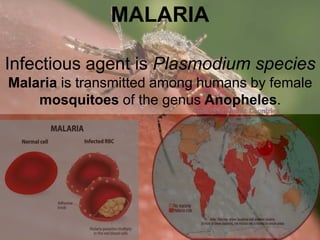 MALARIA
Infectious agent is Plasmodium species
Malaria is transmitted among humans by female
mosquitoes of the genus Anopheles.
 