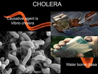 CHOLERA
Causative agent is
Vibrio cholera
Water borne disea
 