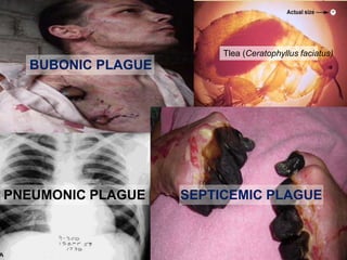 PNEUMONIC PLAGUE SEPTICEMIC PLAGUE
BUBONIC PLAGUE
Tlea (Ceratophyllus faciatus)
 