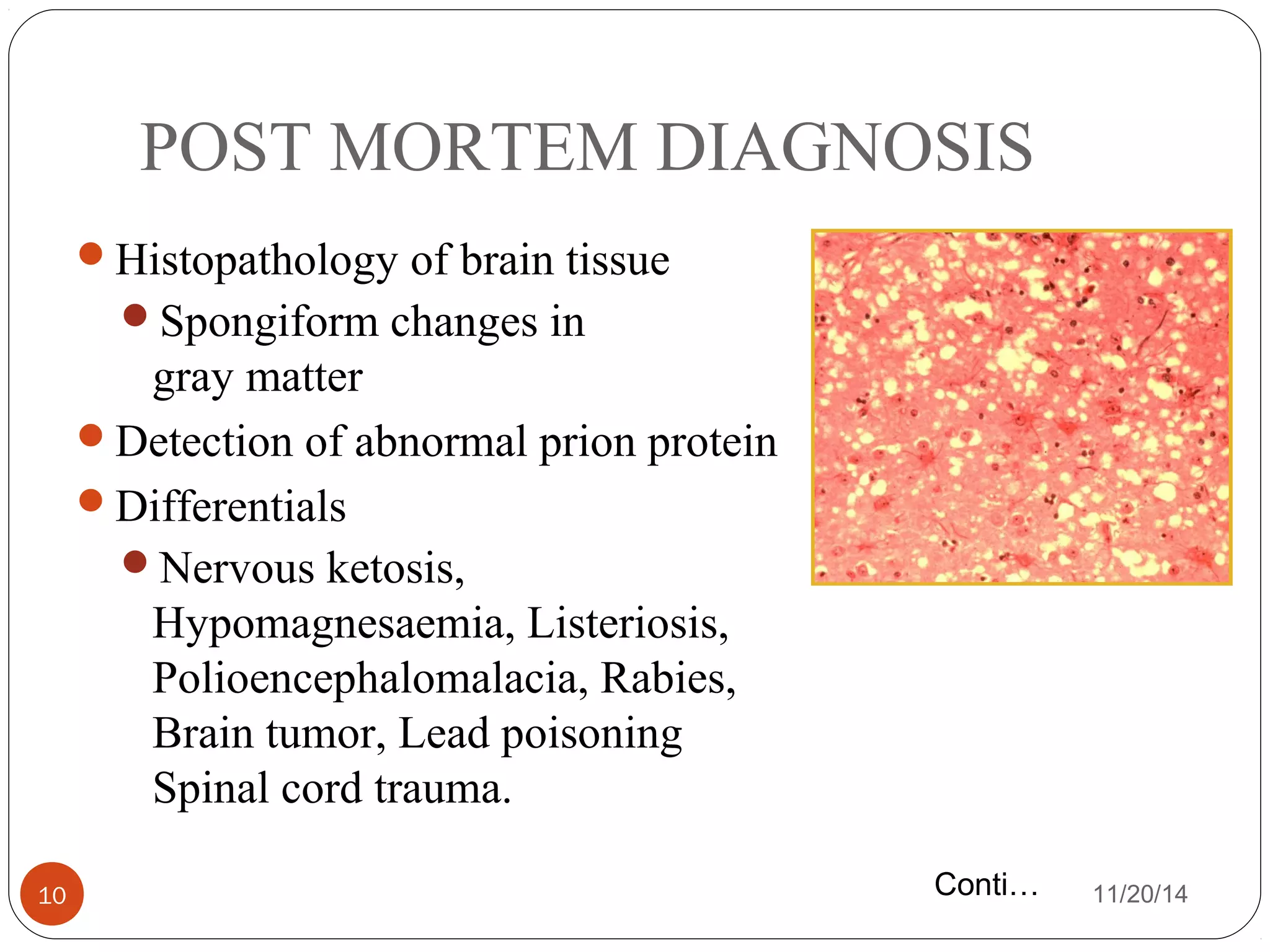 POST MORTEM DIAGNOSIS 
Histopathology of brain tissue 
Spongiform changes in 
gray matter 
Detection of abnormal prion protein 
Differentials 
Nervous ketosis, 
Hypomagnesaemia, Listeriosis, 
Polioencephalomalacia, Rabies, 
Brain tumor, Lead poisoning 
Spinal cord trauma. 
z 
Conti… 
10 11/20/14 
 