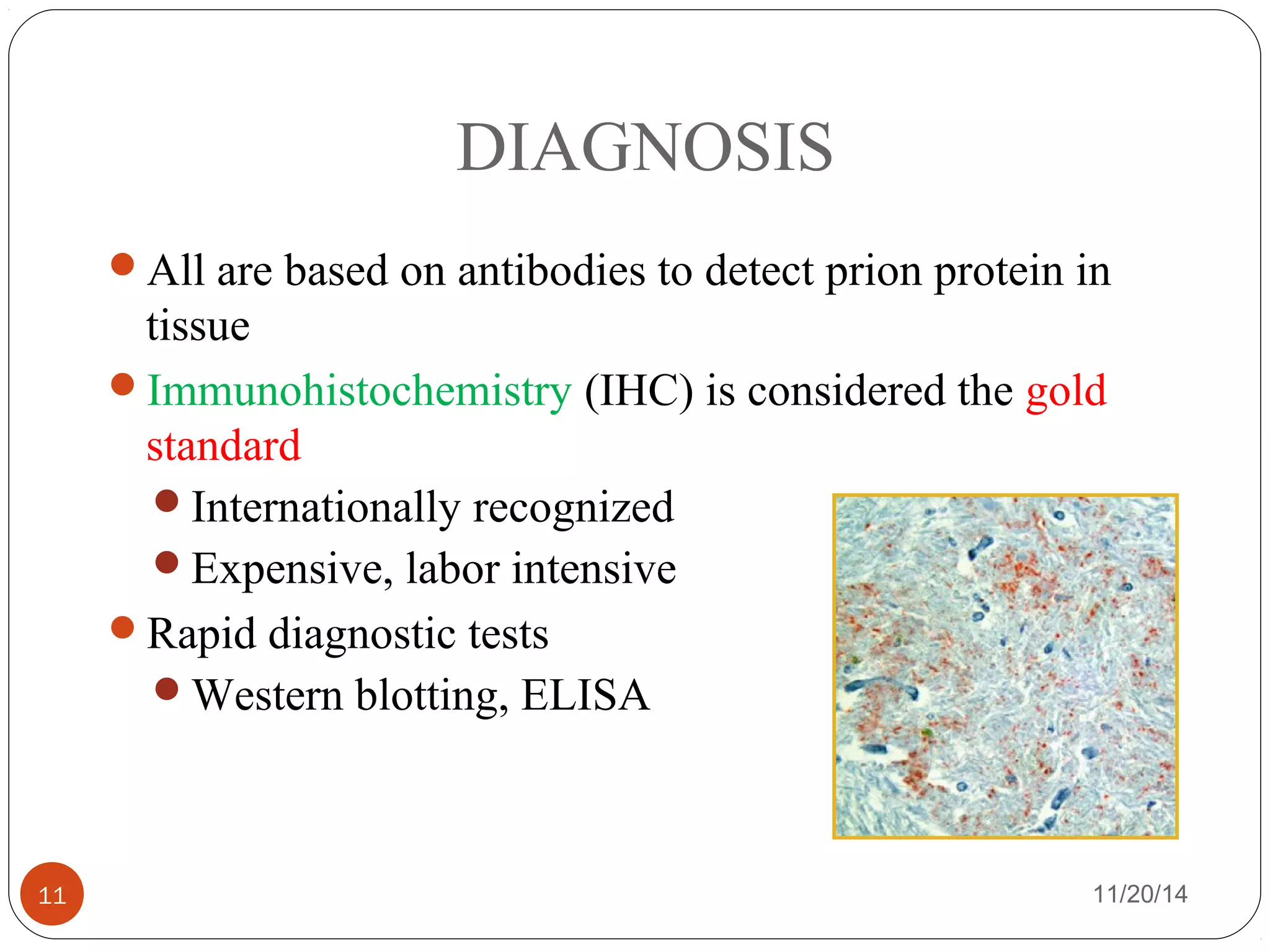 DIAGNOSIS 
All are based on antibodies to detect prion protein in 
tissue 
Immunohistochemistry (IHC) is considered the gold 
standard 
Internationally recognized 
Expensive, labor intensive 
Rapid diagnostic tests 
Western blotting, ELISA 
11 11/20/14 
 