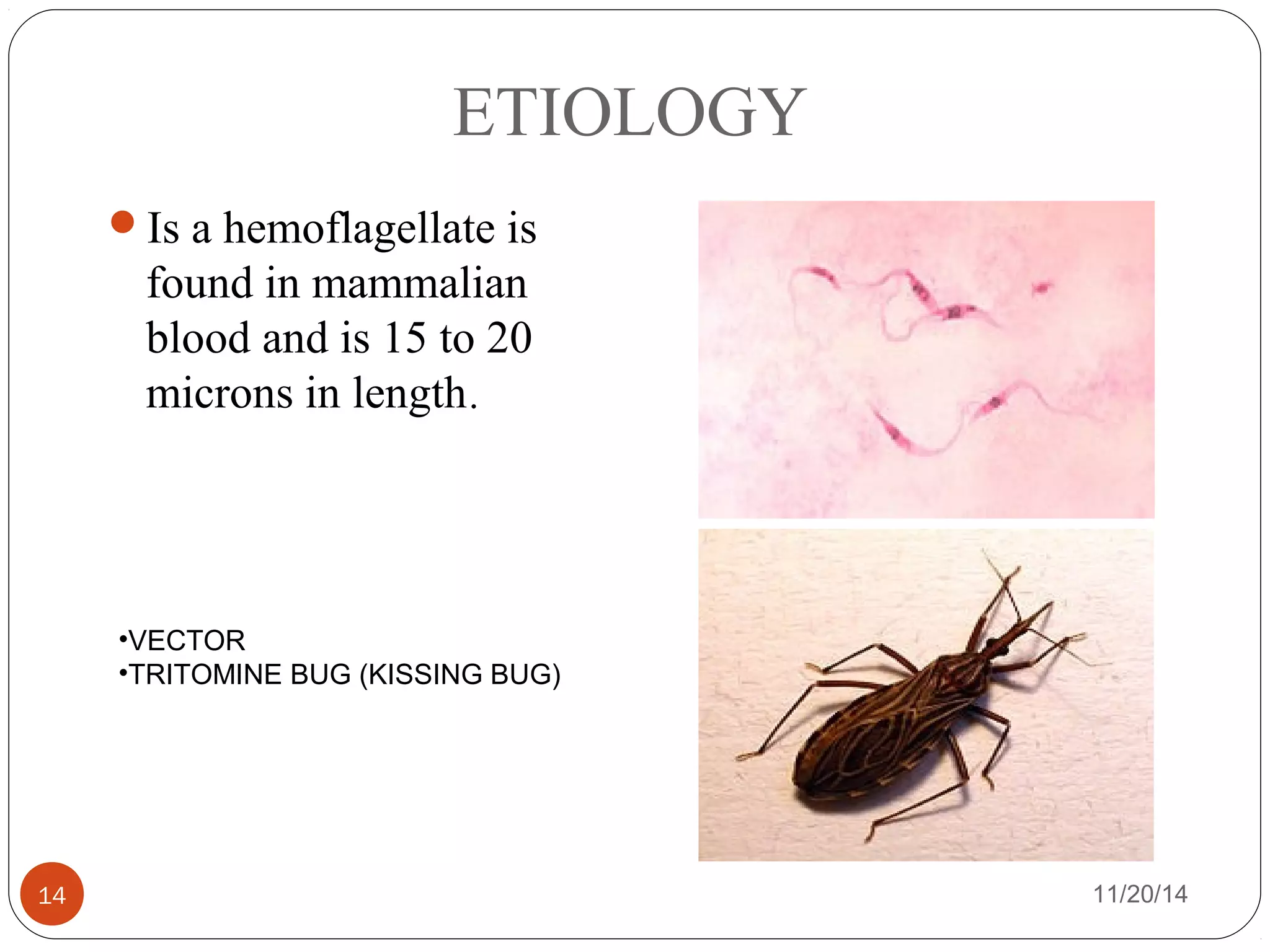 ETIOLOGY 
Is a hemoflagellate is 
found in mammalian 
blood and is 15 to 20 
microns in length. 
•VECTOR 
•TRITOMINE BUG (KISSING BUG) 
14 11/20/14 
 