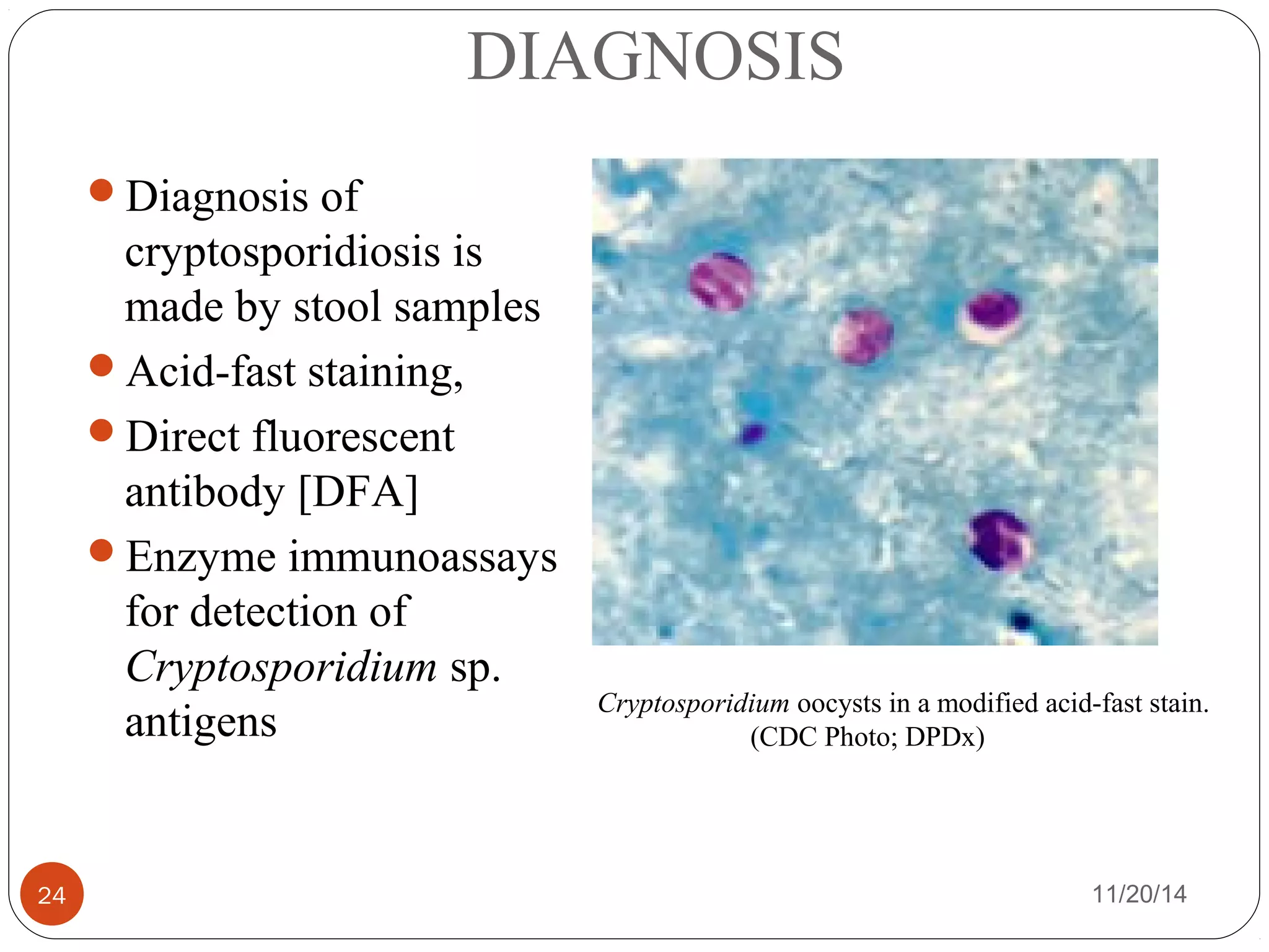 DIAGNOSIS 
Diagnosis of 
cryptosporidiosis is 
made by stool samples 
Acid-fast staining, 
Direct fluorescent 
antibody [DFA] 
Enzyme immunoassays 
for detection of 
Cryptosporidium sp. 
antigens Cryptosporidium oocysts in a modified acid-fast stain. 
(CDC Photo; DPDx) 
24 11/20/14 
 