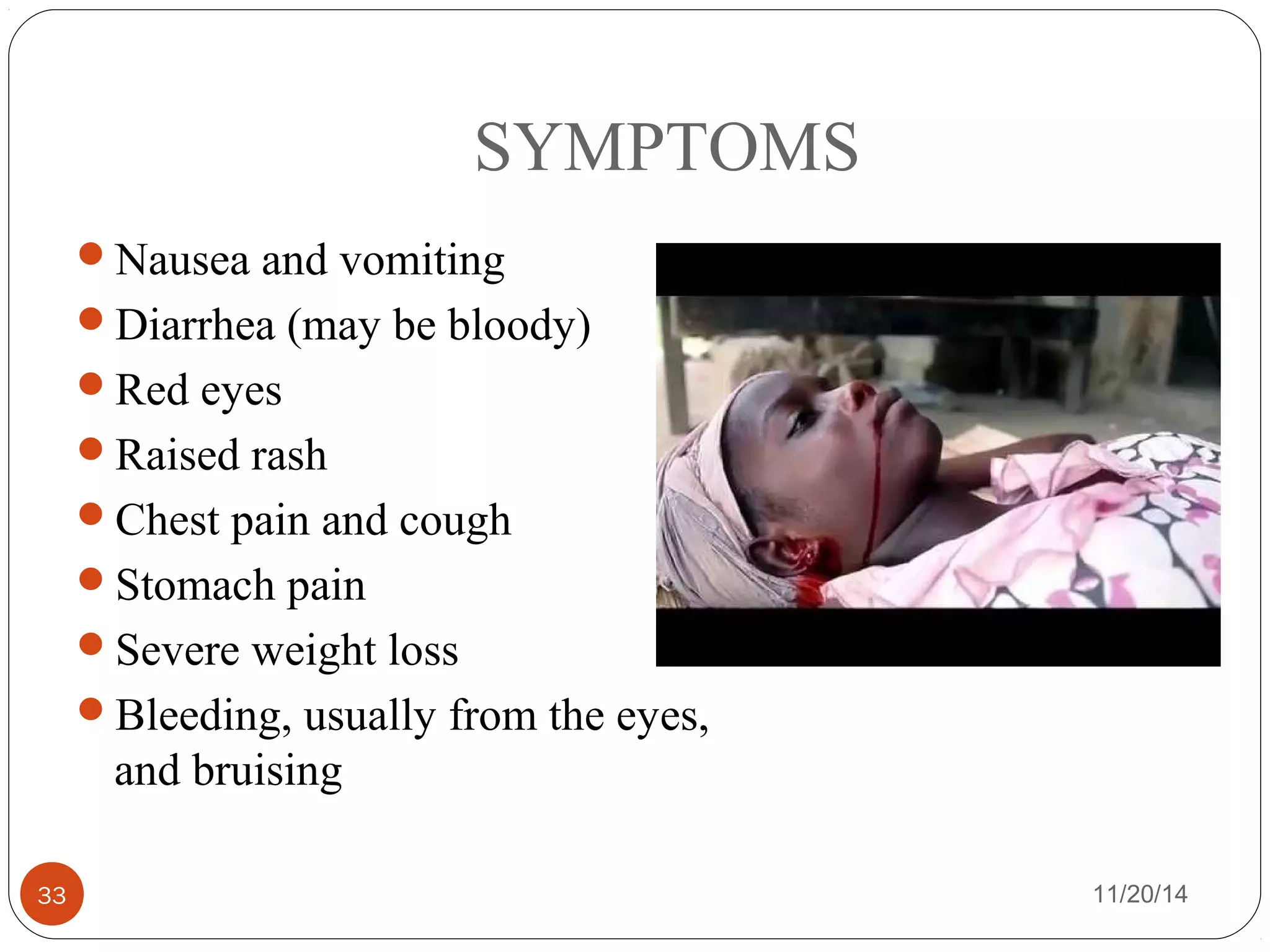 SYMPTOMS 
Nausea and vomiting 
Diarrhea (may be bloody) 
Red eyes 
Raised rash 
Chest pain and cough 
Stomach pain 
Severe weight loss 
Bleeding, usually from the eyes, 
and bruising 
33 11/20/14 
 