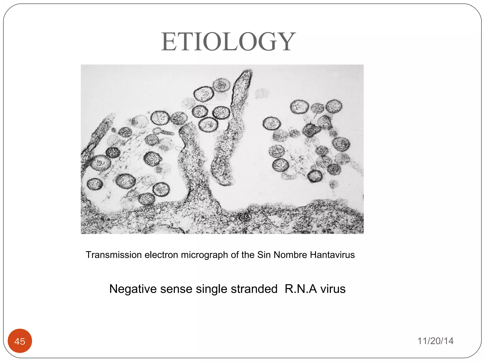 ETIOLOGY 
Transmission electron micrograph of the Sin Nombre Hantavirus 
Negative sense single stranded R.N.A virus 
45 11/20/14 
 