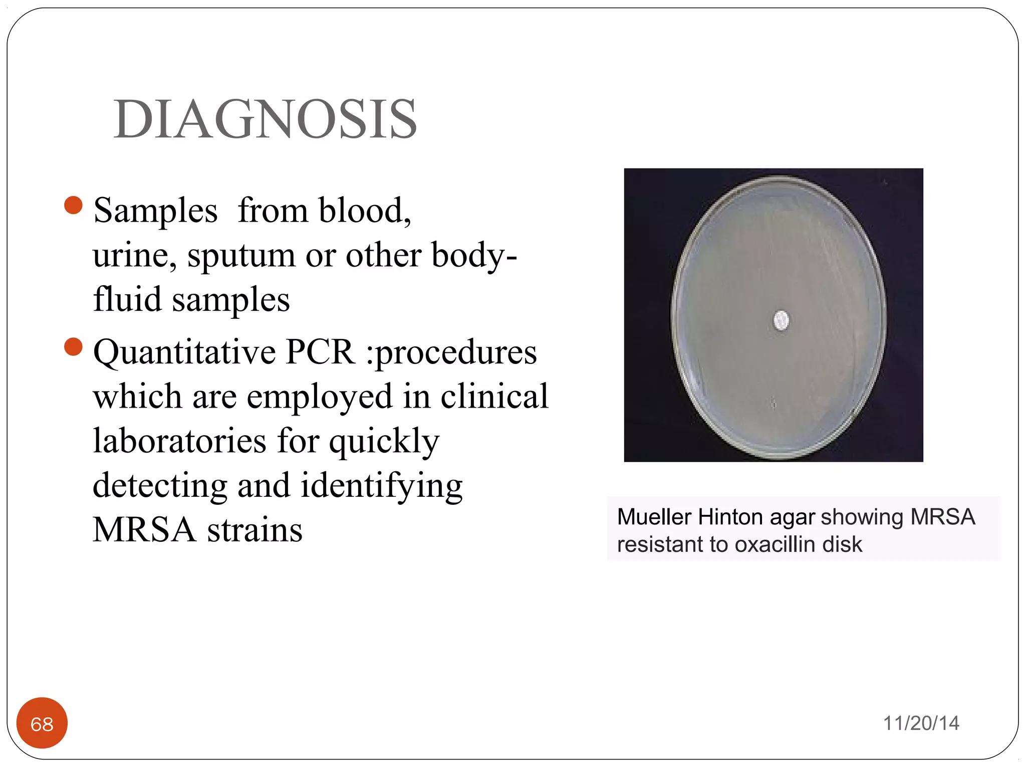 DIAGNOSIS 
Samples from blood, 
urine, sputum or other body-fluid 
samples 
Quantitative PCR :procedures 
which are employed in clinical 
laboratories for quickly 
detecting and identifying 
MRSA strains Mueller Hinton agar showing MRSA 
resistant to oxacillin disk 
68 11/20/14 
 