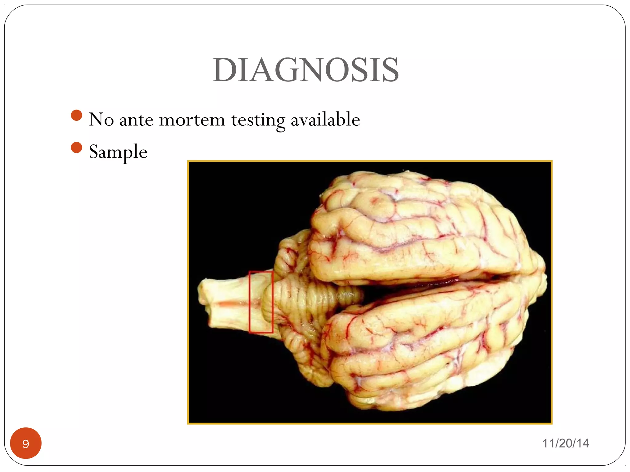 DIAGNOSIS 
No ante mortem testing available 
Sample 
9 11/20/14 
 