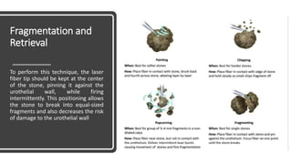 Fragmentation and
Retrieval
To perform this technique, the laser
fiber tip should be kept at the center
of the stone, pinning it against the
urothelial wall, while firing
intermittently. This positioning allows
the stone to break into equal-sized
fragments and also decreases the risk
of damage to the urothelial wall
 