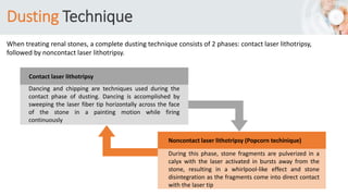 Dusting Technique
Dancing and chipping are techniques used during the
contact phase of dusting. Dancing is accomplished by
sweeping the laser fiber tip horizontally across the face
of the stone in a painting motion while firing
continuously
During this phase, stone fragments are pulverized in a
calyx with the laser activated in bursts away from the
stone, resulting in a whirlpool-like effect and stone
disintegration as the fragments come into direct contact
with the laser tip
Contact laser lithotripsy
Noncontact laser lithotripsy (Popcorn techinique)
When treating renal stones, a complete dusting technique consists of 2 phases: contact laser lithotripsy,
followed by noncontact laser lithotripsy.
 