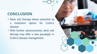 Emerging Treatment Option - Stem Cell Therapy for Crohn's Disease - Dr ...