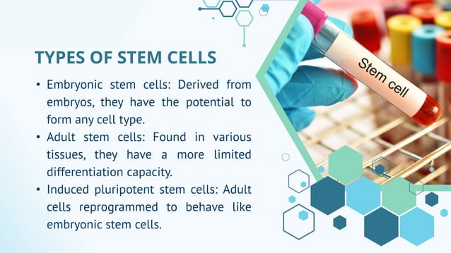 Emerging Treatment Option Stem Cell Therapy For Crohn S Disease Dr