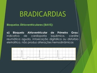 Bloqueios Átrioventriculares (BAVS):
a) Bloqueio Atrioventricular de Primeiro Grau:
indicativo de cardiopatia isquêmica, cardite
reumática aguda, intoxicação digitálica ou distúrbio
eletrolítico, não produz alterações hemodinâmicas
BRADICARDIAS
 
