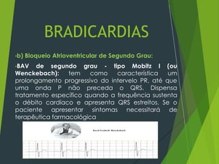 •b) Bloqueio Atrioventricular de Segundo Grau:
•BAV de segundo grau - tipo Mobitz I (ou
Wenckebach): tem como característica um
prolongamento progressivo do intervelo PR, até que
uma onda P não preceda o QRS. Dispensa
tratamento específico quando a frequência sustenta
o débito cardíaco e apresenta QRS estreitos. Se o
paciente apresentar sintomas necessitará de
terapêutica farmacológica
BRADICARDIAS
 