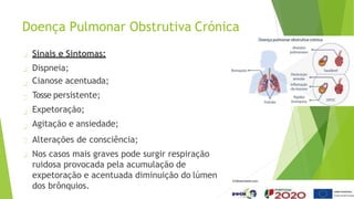 Doença Pulmonar Obstrutiva Crónica
Sinais e Sintomas:
Dispneia;
Cianose acentuada;
Tosse persistente;
Expetoração;
Agitação e ansiedade;
Alterações de consciência;
Nos casos mais graves pode surgir respiração
ruidosa provocada pela acumulação de
expetoração e acentuada diminuição do lúmen
dos brônquios.
 