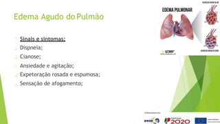 Edema Agudo do Pulmão
Sinais e sintomas:
Dispneia;
Cianose;
Ansiedade e agitação;
Expetoração rosada e espumosa;
Sensação de afogamento;
 