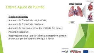 Edema Agudo do Pulmão
Sinais e sintomas:
Aumento da frequência respiratória;
Aumento da frequência cardíaca;
Aumento da pressão arterial (na maioria dos casos);
Palidez e sudorese;
Respiração ruidosa tipo farfalheira, comparável ao som
provocado por uma panela de água a ferver.
 