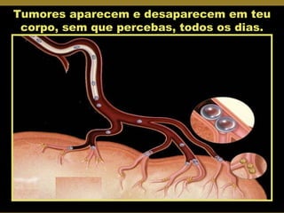 Tumores aparecem e desaparecem em teu corpo, sem que percebas, todos os dias. 