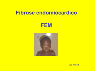 Fibrose endomiocardico
FEM
Dra Annett
 