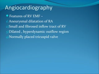 Angiocardiography
Features of RV EMF –
1) Aneurysmal dilatation of RA
2)Small and fibrosed inflow tract of RV
3)Dilated , hyperdynamic outflow region
4)Normally placed tricuspid valve
 