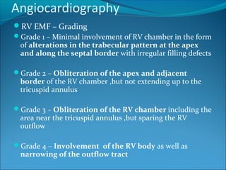 Angiocardiography
RV EMF – Grading
Grade 1 – Minimal involvement of RV chamber in the form
of alterations in the trabecular pattern at the apex
and along the septal border with irregular filling defects
Grade 2 – Obliteration of the apex and adjacent
border of the RV chamber ,but not extending up to the
tricuspid annulus
Grade 3 – Obliteration of the RV chamber including the
area near the tricuspid annulus ,but sparing the RV
outflow
Grade 4 – Involvement of the RV body as well as
narrowing of the outflow tract
 