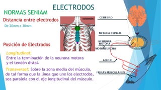 ELECTRODOS
NORMAS SENIAM
Transversal: Sobre la zona media del músculo,
de tal forma que la línea que une los electrodos,
sea paralela con el eje longitudinal del músculo.
Distancia entre electrodos
De 20mm a 30mm.
Posición de Electrodos
Longitudinal:
Entre la terminación de la neurona motora
y el tendón distal.
 