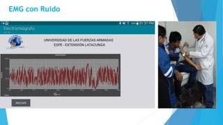 EMG con Ruido
 