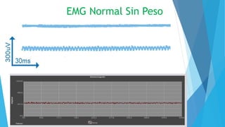 EMG Normal Sin Peso
 