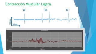 Contracción Muscular Ligera
 