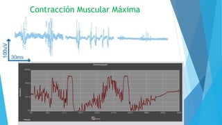 Contracción Muscular Máxima
 