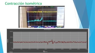 Contracción Isométrica
 