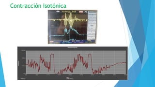 Contracción Isotónica
 