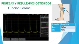 PRUEBAS Y RESULTADOS OBTENIDOS
Función Peroné
Onda alfa Onda beta
2 ms 160 us
6 Hz 75 Hz
 