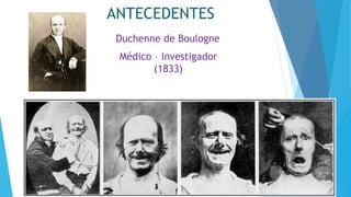 Duchenne de Boulogne
Médico – Investigador
(1833)
ANTECEDENTES
 