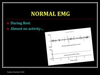 NORMAL EMG
 During Rest
 Almost no activity…
Tuesday, December 6, 2022
 