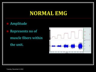 NORMAL EMG
 Amplitude
 Represents no of
muscle fibers within
the unit.
Tuesday, December 6, 2022
 